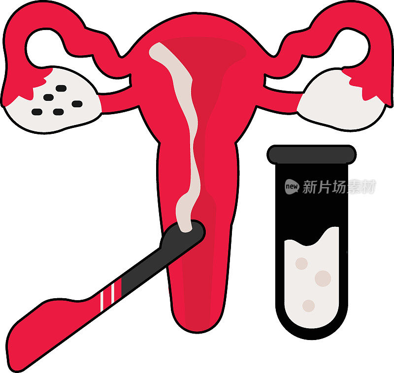 IVF TVOR矢量彩色图标设计，体外受精符号，怀孕和产科医生标志，试管婴儿程序库存插图，经阴道卵母细胞检索概念